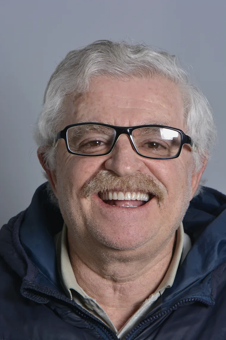 All-on-4 patient after treatment at Oral Synergy Cuenca